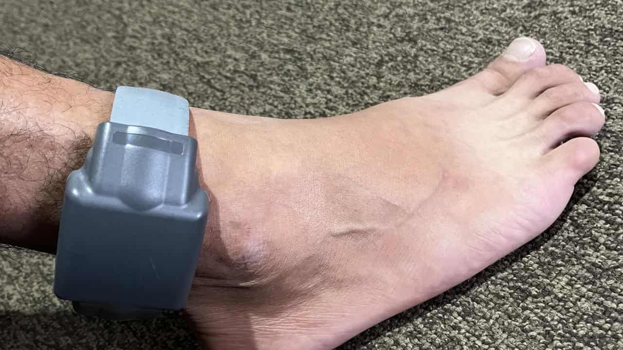 A monitoring ankle bracelet strapped on released immigration detainees