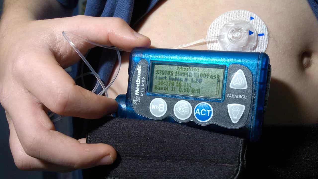 Insulin pump at a Sydney hospital