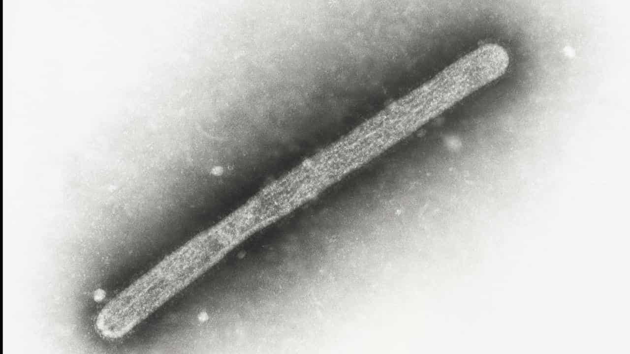 An electron microscope image showing an avian influenza A H5N1 virion.