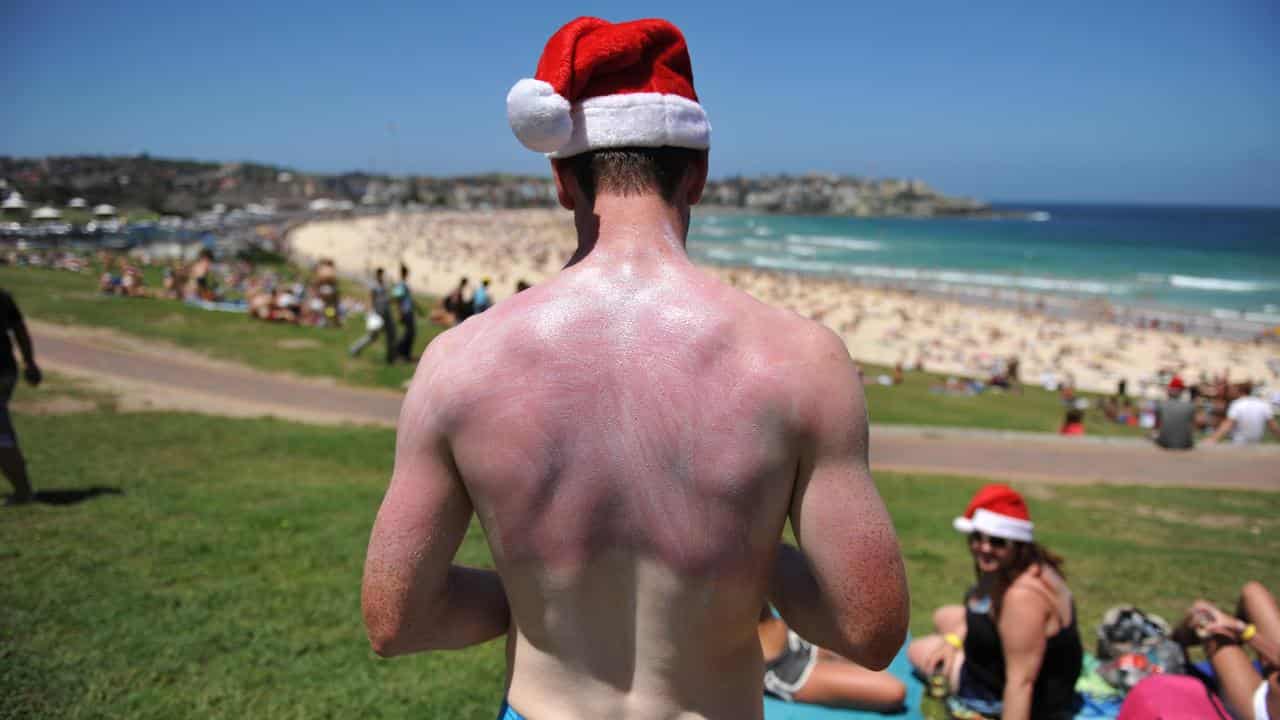 A sunburnt backpacker at Bondi Beach on Christmas Day in Sydney