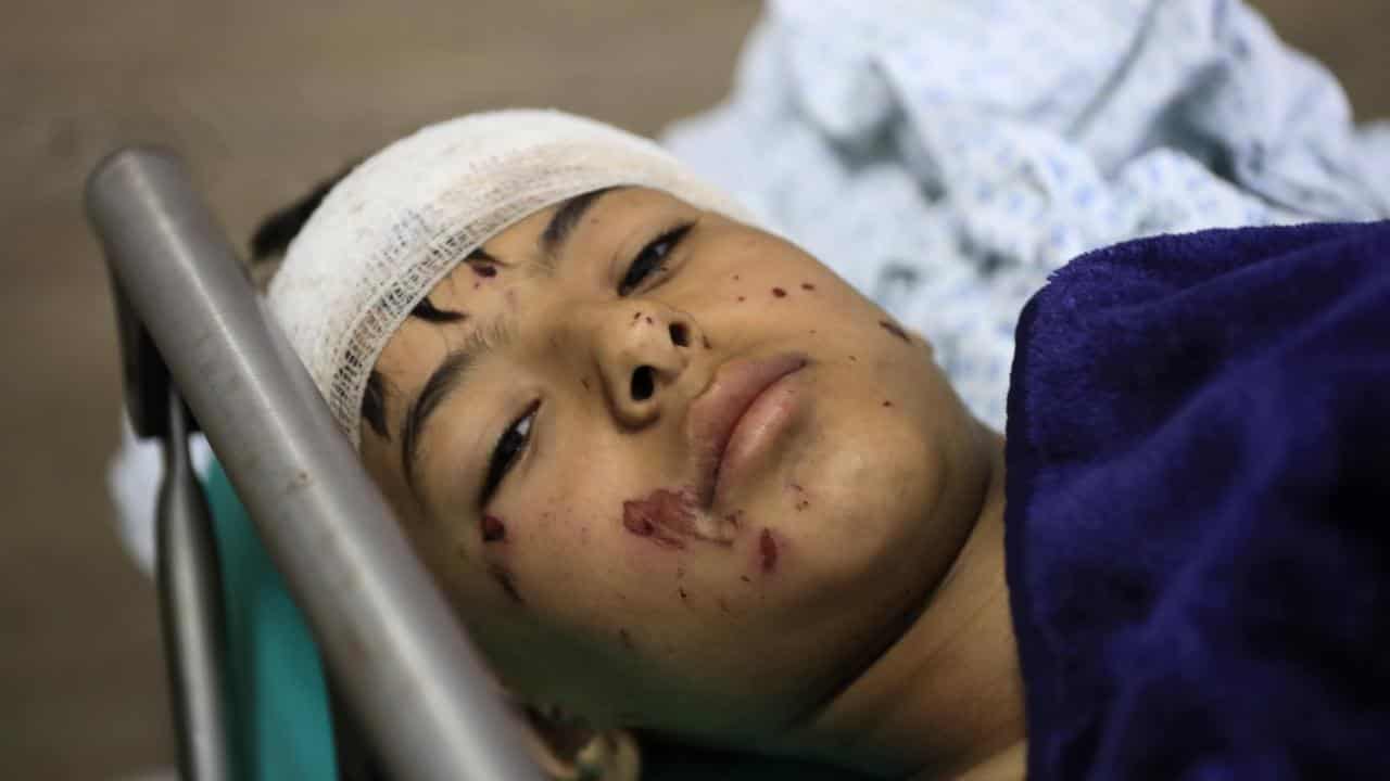 A wounded boy lies in a hospital bed in Lebanon