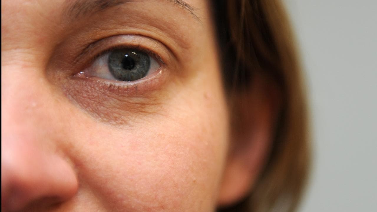 A detailed image of a woman's eye