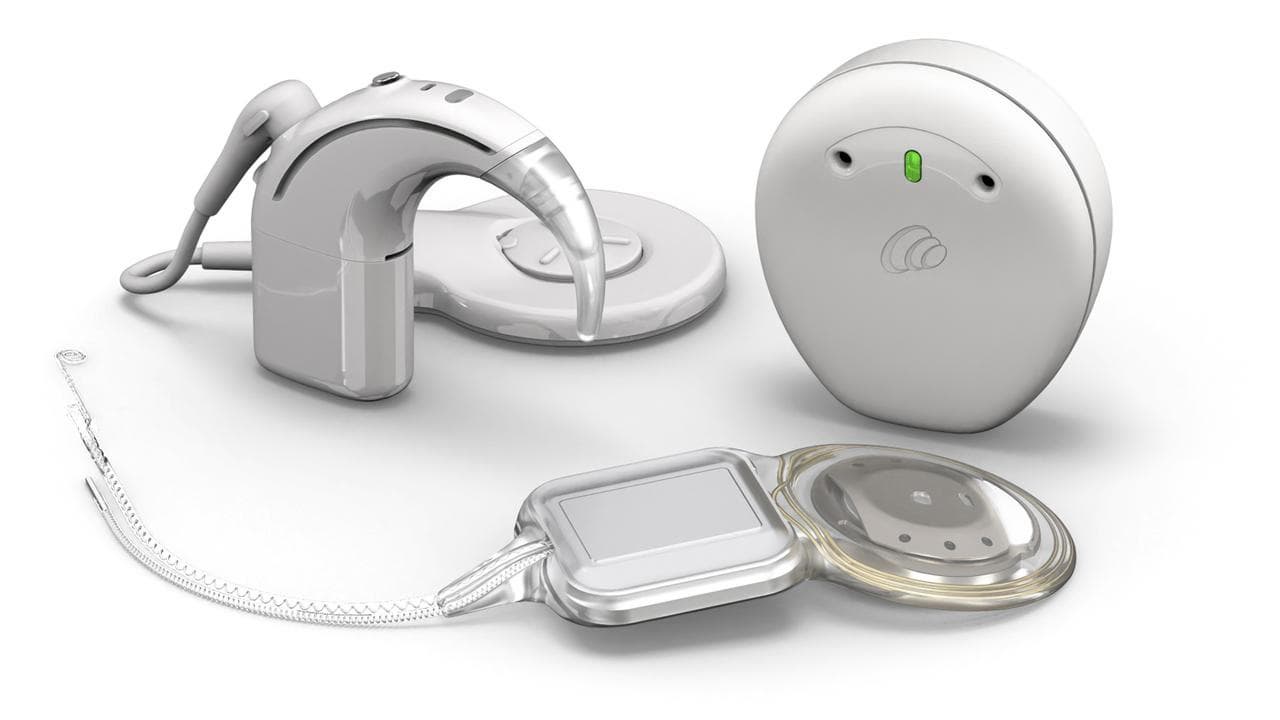 Cochlear’s 8th-generation Nucleus Nexa System hearing implant