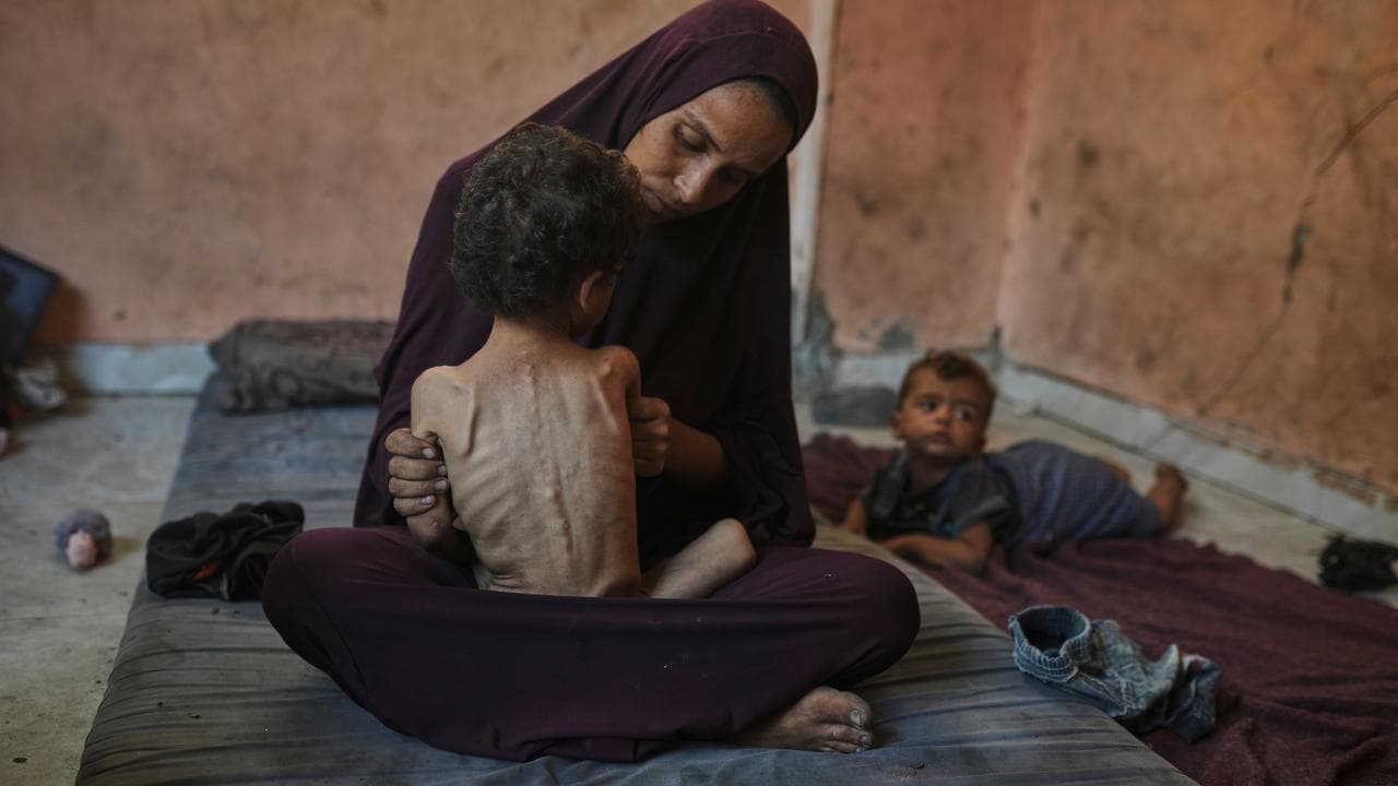 A malnourished child and mother in Gaza