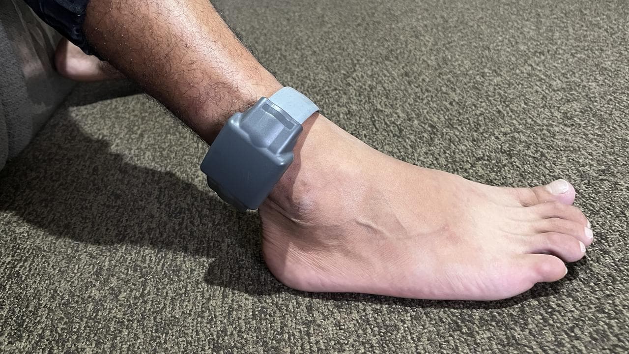 A file photo of an ankle monitor 