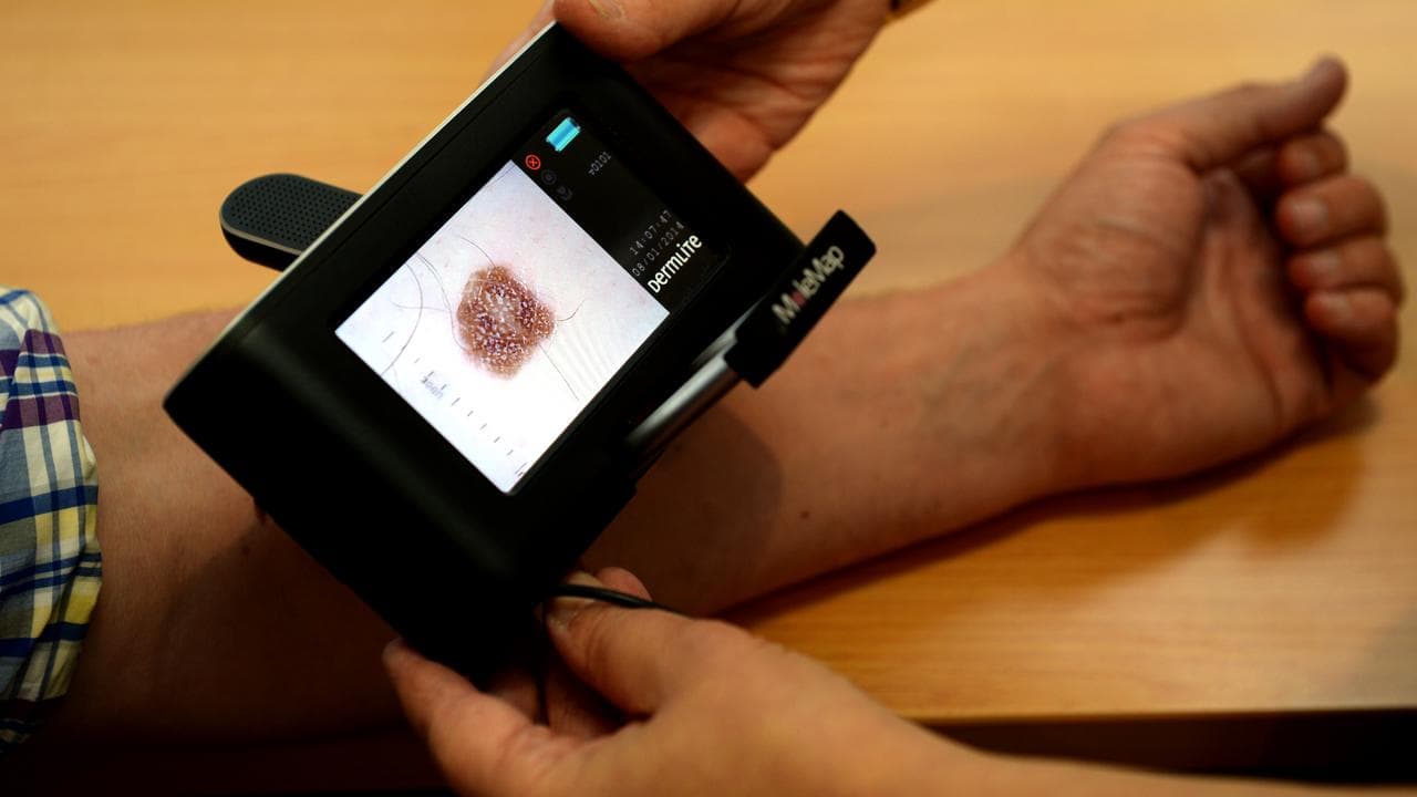 Patient checked for skin cancers at a skin cancer clinic in Sydney