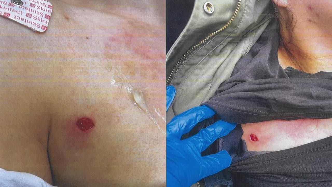 Wan Lai's injuries (file)