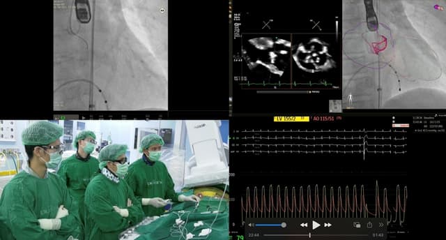 Siriraj Hospital Shines Spotlight on TAVI Procedure as Alternative for High-Risk Patients Requiring Aortic Valve Replacement