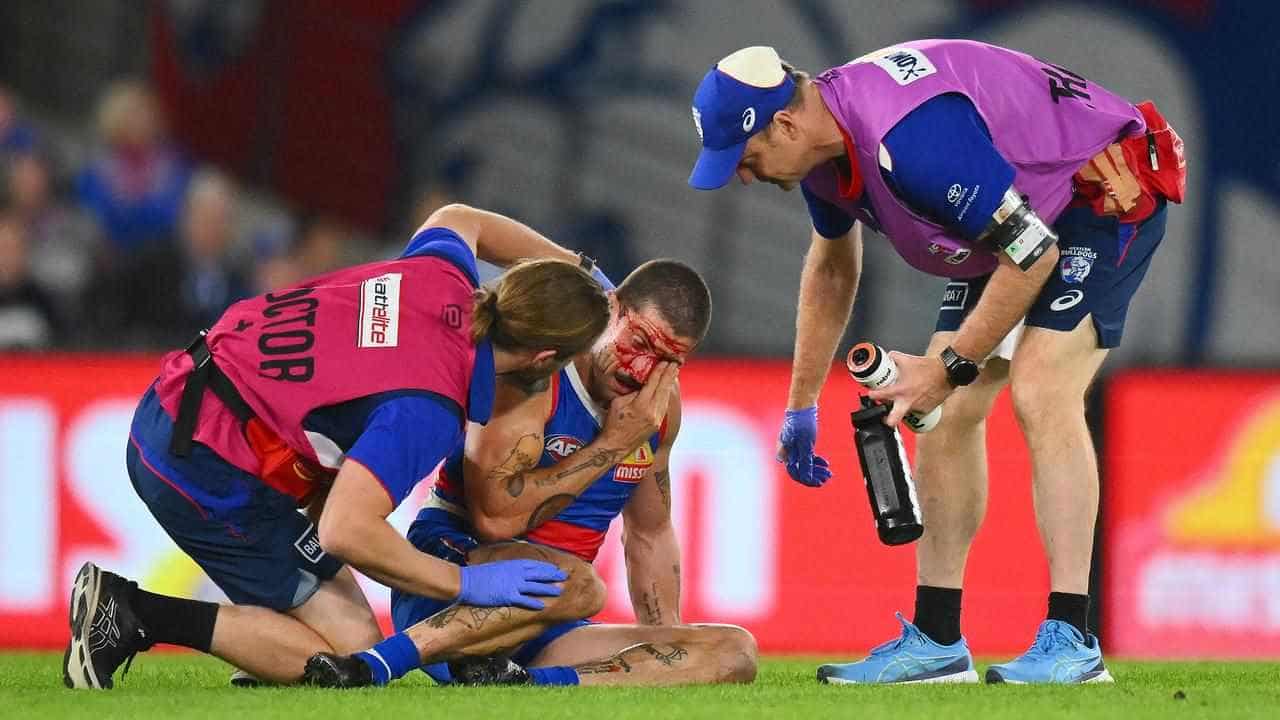 Bulldogs rule out Liberatore, confirming concussion