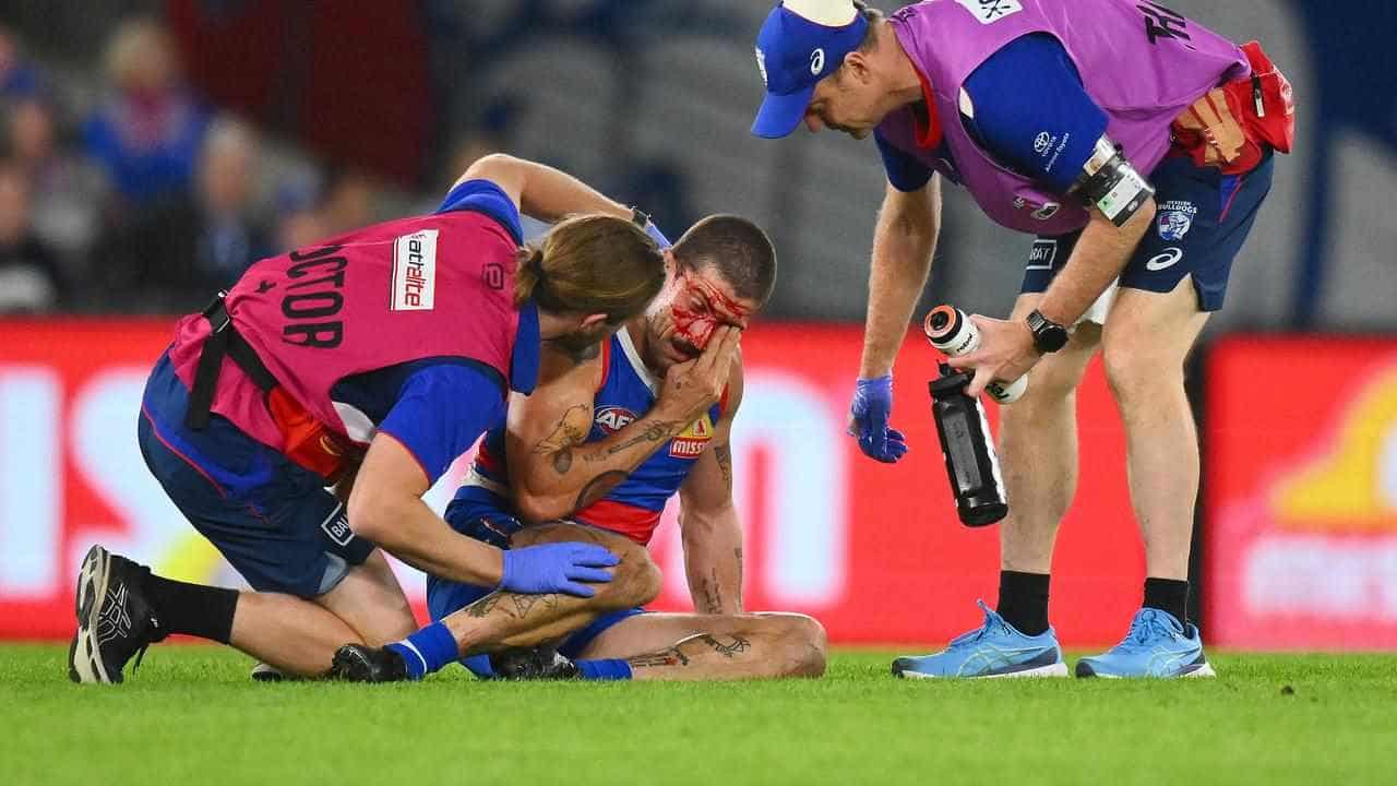 Liberatore set for AFL return after concussion concerns