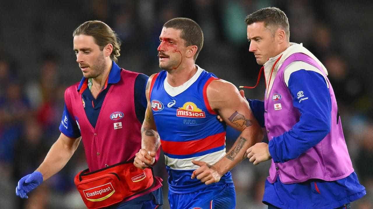 Bulldogs' Liberatore to tweak approach on AFL return