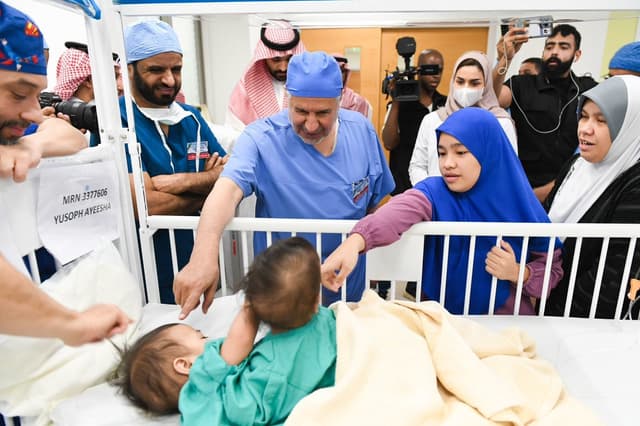 Successful Separation Surgery Gives Hope to Filipina Conjoined Twins in Riyadh