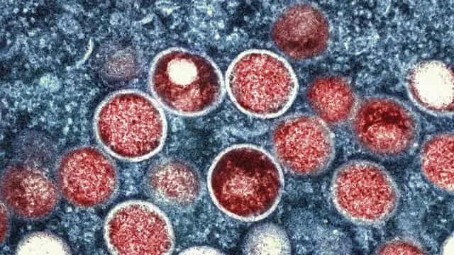 Mpox virus detected in Pakistan, health authorities say