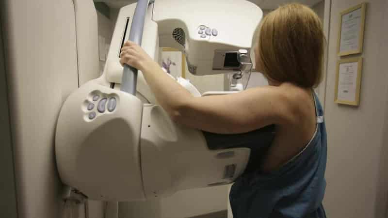 No truth to Swiss ban on mammograms claim