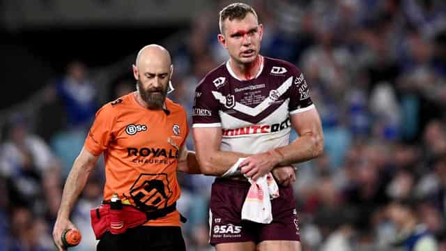 Manly star hurt in win but tipped to play finals