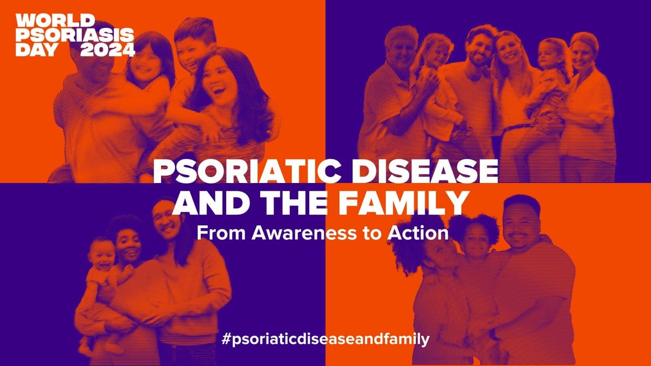 World Psoriasis Day 2024: Psoriatic Disease and Family--Standing Together in Support and Understanding