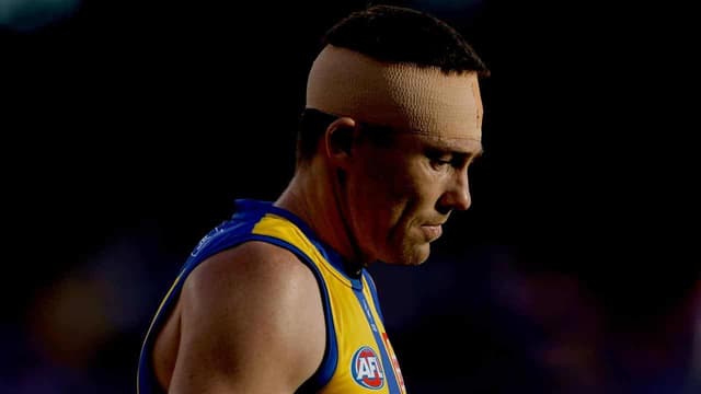 Concussions could force Eagles star McGovern to retire