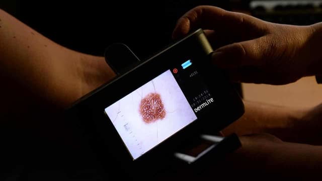 Likely cancer case surge raises health system worries