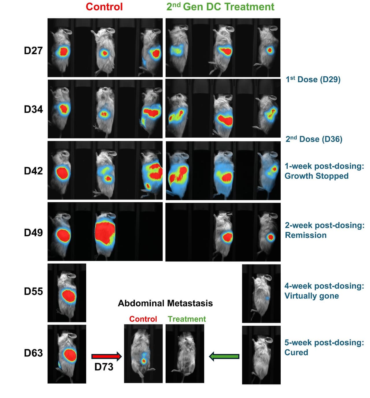Lunai Bioworks achieves complete regression of both primary and metastatic pancreatic tumors in preclinical humanized models, marking a breakthrough in allogeneic cancer immunotherapy
