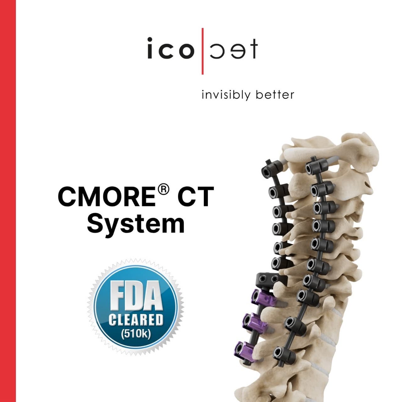 icotec Receives FDA Clearance for the CMORE® CT System, Expanding its BlackArmor® Engineered Carbon/PEEK Technology to the Posterior Cervicothoracic Spine