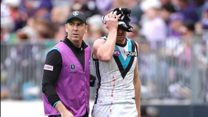 Port Adelaide content with Jonas head-knock protocols