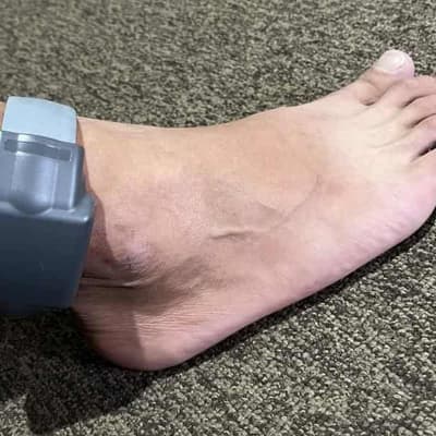 Bail denied after ankle monitor removed before arrest