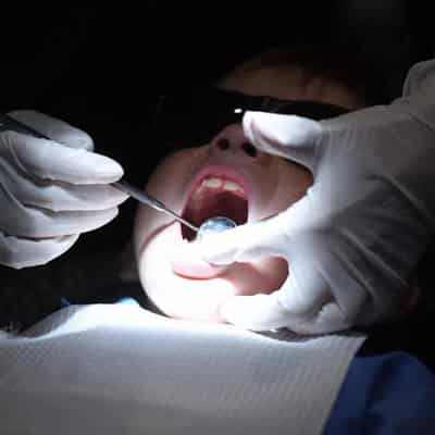 Disadvantaged regions at risk of dental decay: study