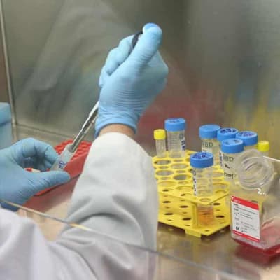 Hope after research breakthrough for psoriasis patients