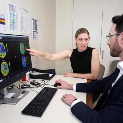 New drug to reduce brain cell death in stroke patients