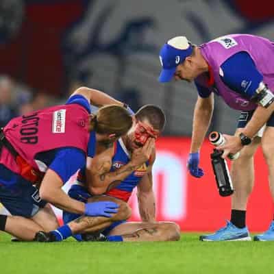 Bulldogs rule out Liberatore, confirming concussion