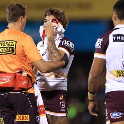 Game over for NRL teams who lose backs while trailing