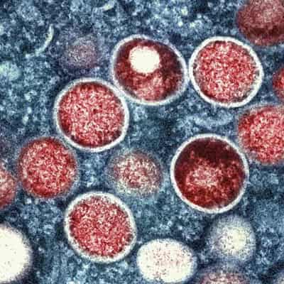 Mpox virus detected in Pakistan, health authorities say