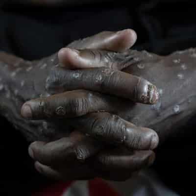 No, US government agency did not say there's no evidence of mpox