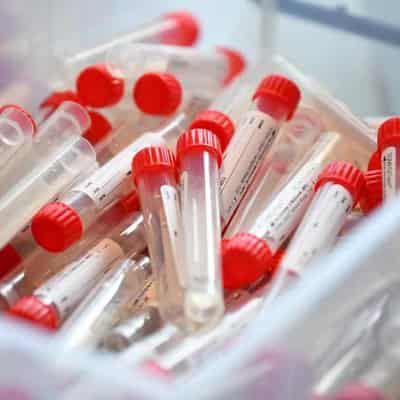 Neither Bill Gates nor 'Disease X' involved in biosecurity breach