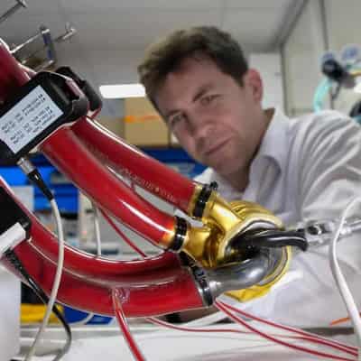 World-first discharge for artificial heart patient