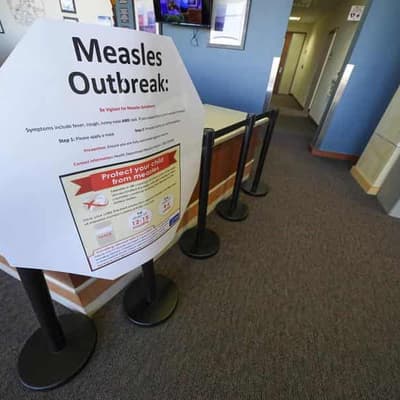 Misinformation spreads amid measles outbreak