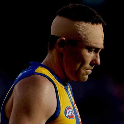 Concussions could force Eagles star McGovern to retire