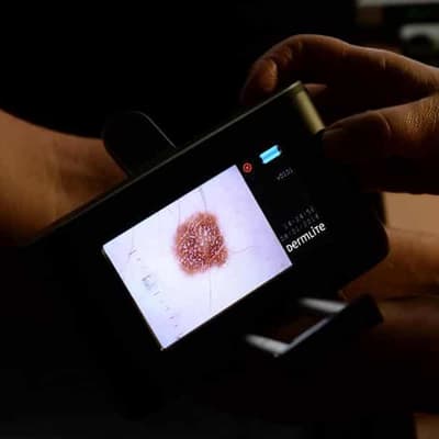 Likely cancer case surge raises health system worries