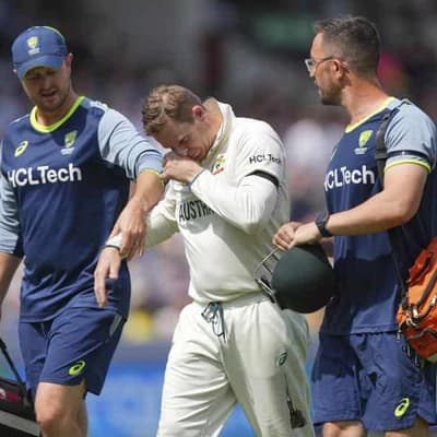 The 'good result' from Steve Smith's finger dislocation
