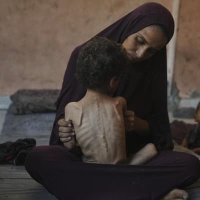 Doctors can't help as children starve to death in Gaza