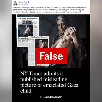 Former MP misidentifies 'never starving' Palestinian child