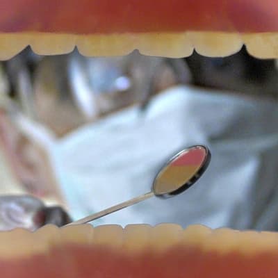 Dentists urged not to promote early super extractions