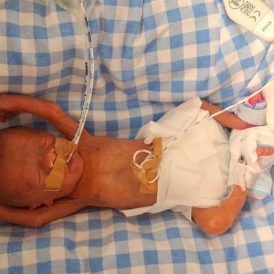 History-making miracle premmie continues to defy odds