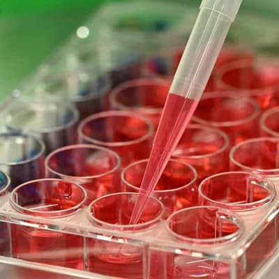 UQ forges global deal to create home-grown vaccines