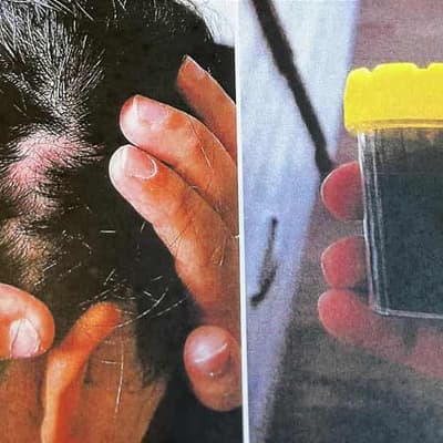 Mum-killer's extra jail time after pulling out hair